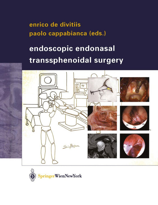 Endoscopic Endonasal Transsphenoidal Surgery by Enrico de Divitiis