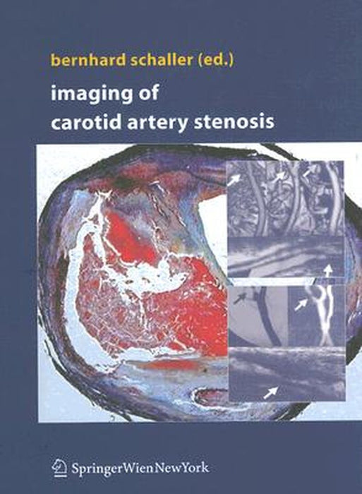 Imaging of Carotid Artery Stenosis by Bernhard Schaller