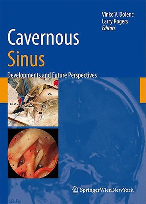 Cavernous Sinus: Developments and Future Perspectives by Vinko V. Dolenc