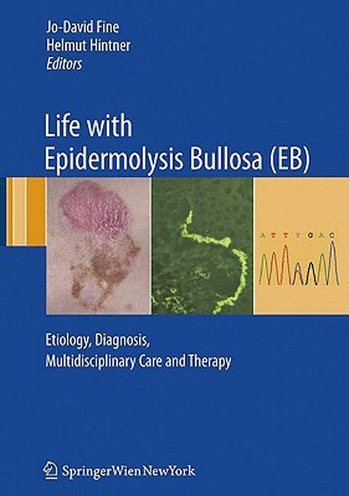 Life with Epidermolysis Bullosa (EB): Etiology, Diagnosis, Multidisciplinary Care and Therapy by Jo-David Fine
