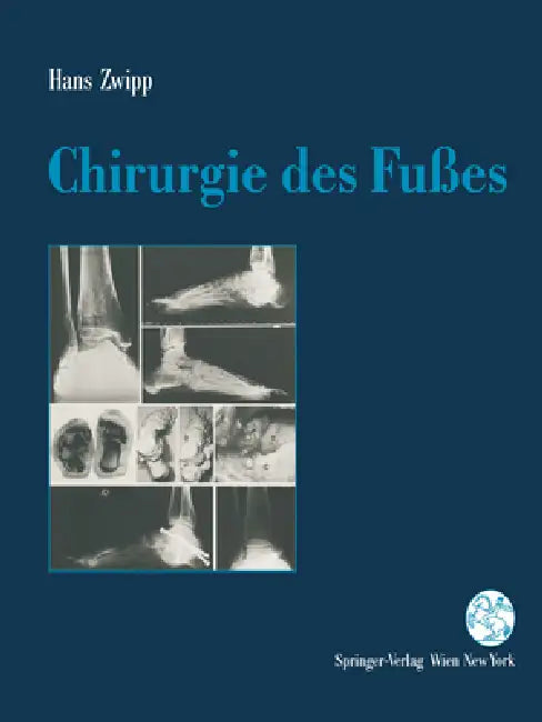 Chirurgie Des Fuaes by Hans Zwipp