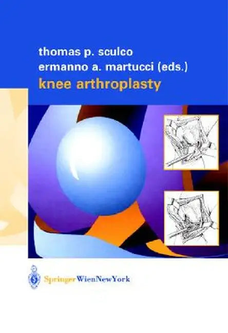 Knee Arthroplasty by Thomas P. Sculco