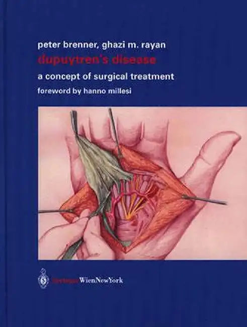 Dupuytren's Disease: A Concept of Surgical Treatment by Peter Brenner