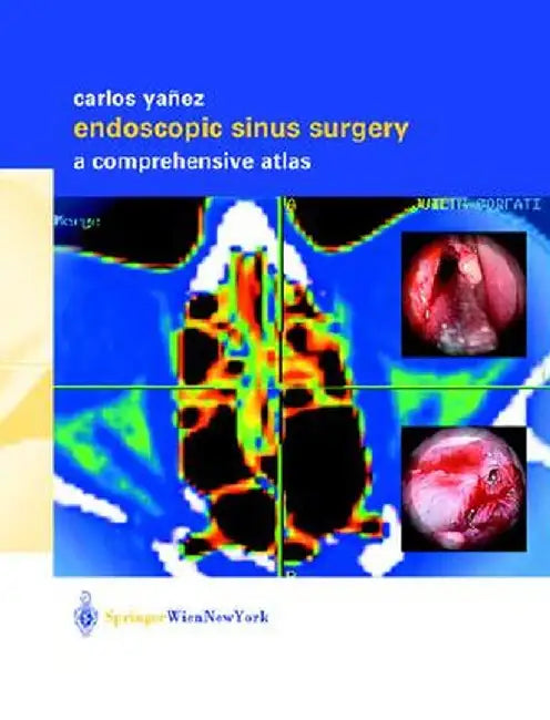 Endoscopic Sinus Surgery: A Comprehensive Atlas by Carlos Yañez