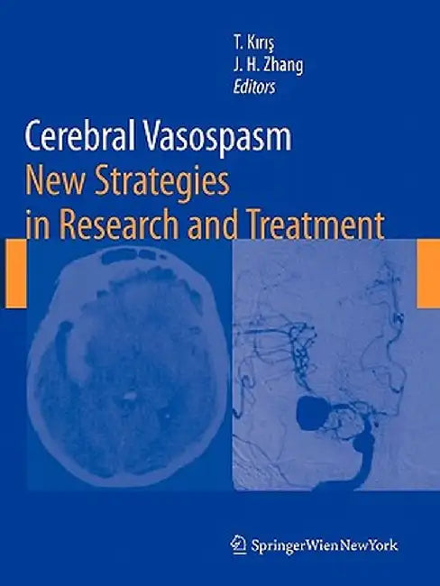 Cerebral Vasospasm: New Strategies in Research and Treatment by Talat Kiris