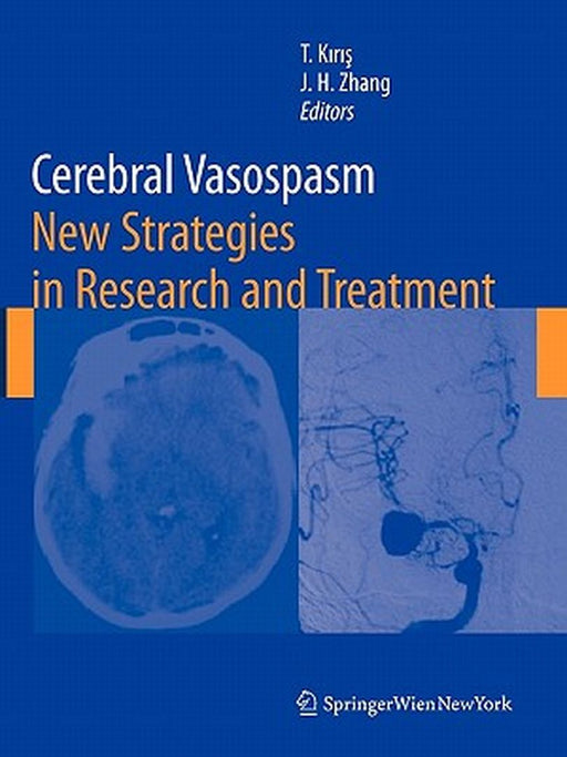 Cerebral Vasospasm: New Strategies in Research and Treatment by Talat Kiris