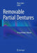 Removable Partial Dentures: A Practitioners Manual by Olcay Akar