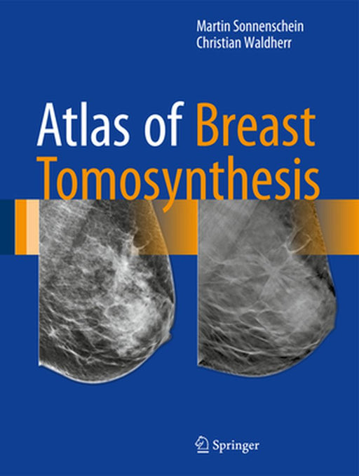 Atlas of Breast Tomosynthesis: Imaging Findings and Image-Guided Interventions by Martin Sonnenschein