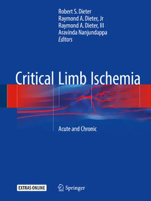 Critical Limb Ischemia: Acute and Chronic by Robert S. Dieter