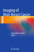 Imaging of Male Breast Cancer by Alexander N. Sencha