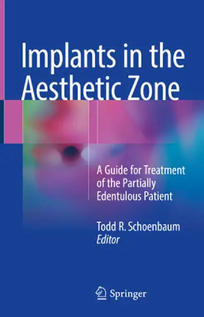 Implants in the Aesthetic Zone: A Guide for Treatment of the Partially Edentulous Patient by Todd R. Schoenbaum
