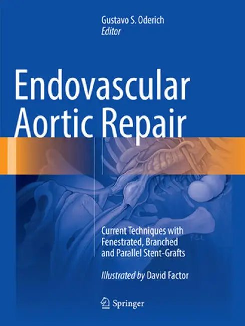 Endovascular Aortic Repair: Current Techniques with Fenestrated, Branched and Parallel Stent-Grafts by Gustavo S. Oderich