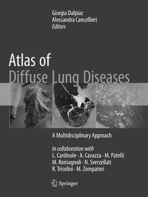 Atlas of Diffuse Lung Diseases: A Multidisciplinary Approach by Giorgia Dalpiaz
