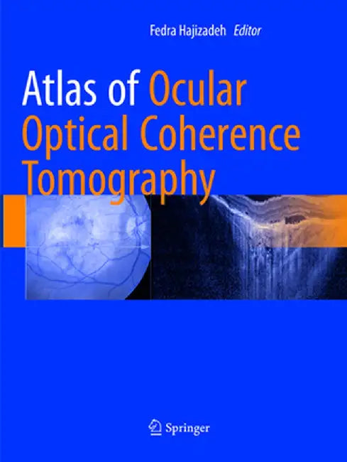 Atlas of Ocular Optical Coherence Tomography by Fedra Hajizadeh