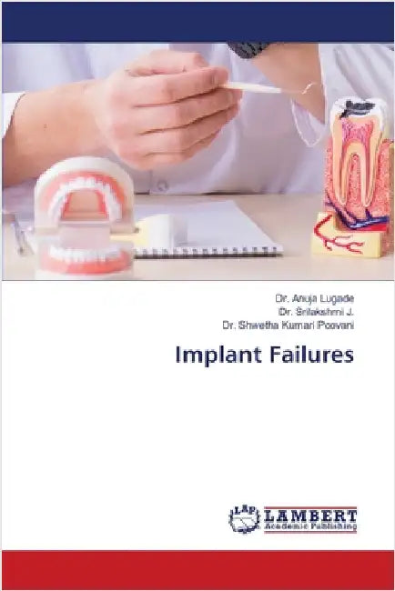 Implant Failures by Lugade, Anuja