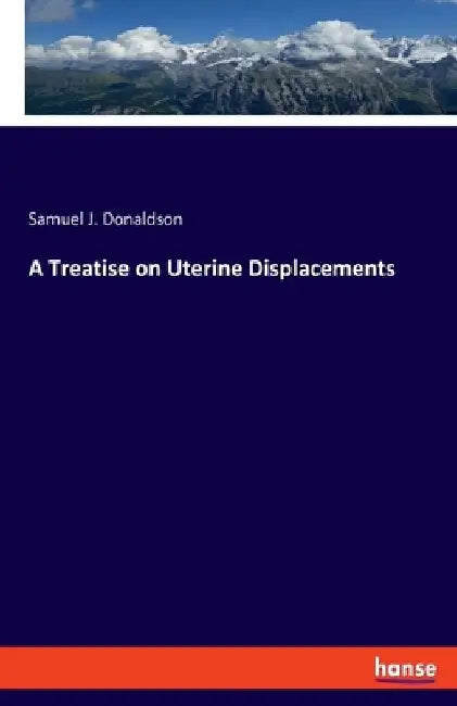 A Treatise on Uterine Displacements by Samuel J. Donaldson