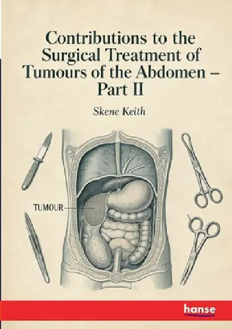 Contributions to the Surgical Treatment of Tumours of the Abdomen: Part II by Skene Keith