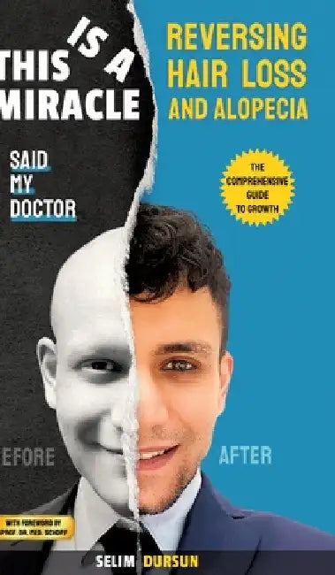 This Is a Miracle Said My Doctor: Reversing Hair Loss and Alopecia by Selim Dursun