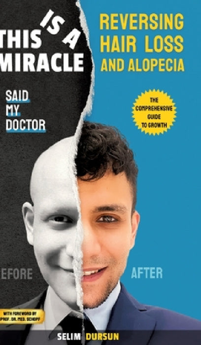This Is a Miracle Said My Doctor: Reversing Hair Loss and Alopecia by Selim Dursun