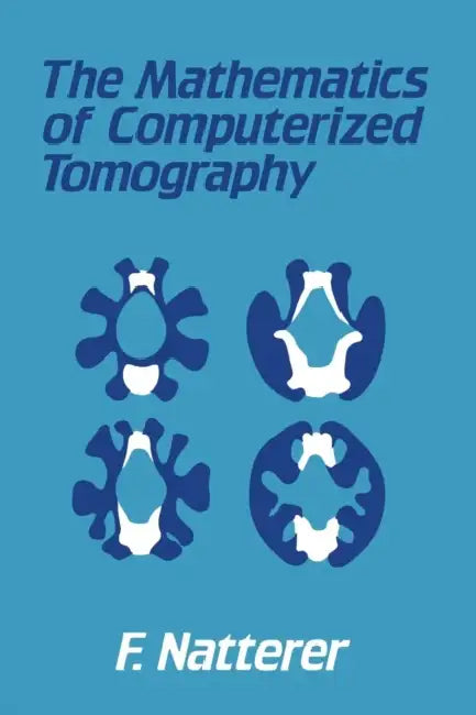 The Mathematics of Computerized Tomography by F. Natterer