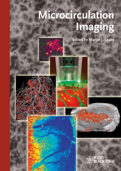 Microcirculation Imaging by Martin J. Leahy