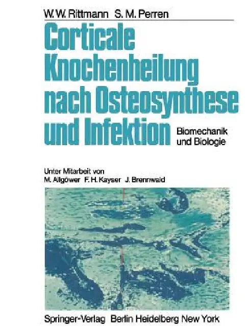 Corticale Knochenheilung Nach Osteosynthese Und Infektion: Biomechanik Und Biologie by M. Allgöwer, W. W. Rittmann, F. H. Kayser