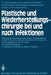 Plastische Und Wiederherstellungschirurgie Bei Und Nach Infektionen: Pathologie Chemotherapie Klinik Rehabilitation by F. Hollwich, J. Probst, G. Pfeifer