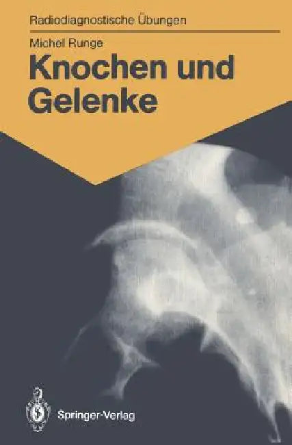 Knochen Und Gelenke: 170 Diagnostische Übungen Für Studenten Und Praktische Radiologen by Michel Runge, Eleonore Bromhorst, Elisabeth Hauenstein