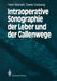 Intraoperative Sonographie Der Leber Und Der Gallenwege by Henri Bismuth, Christian Kujat, Denis Castaing