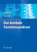 Das Lumbale Facettensyndrom by N. Schippers, Jörg Jerosch, P. M. Faustmann
