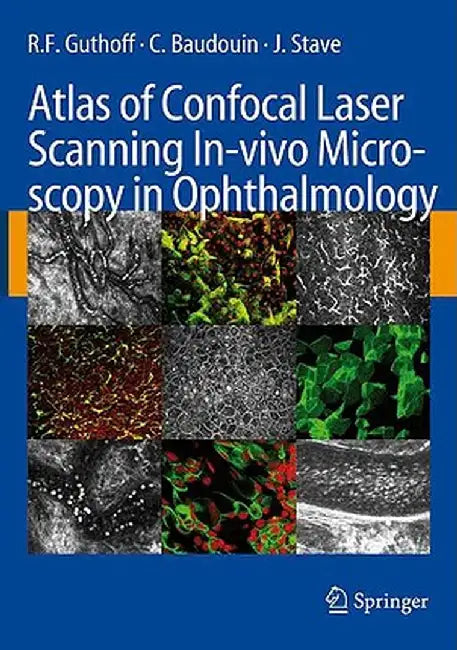Atlas of Confocal Laser Scanning In-Vivo Microscopy in Ophthalmology: Principles and Applications in Diagnostic and Therapeutic Ophtalmology by R. F. Guthoff