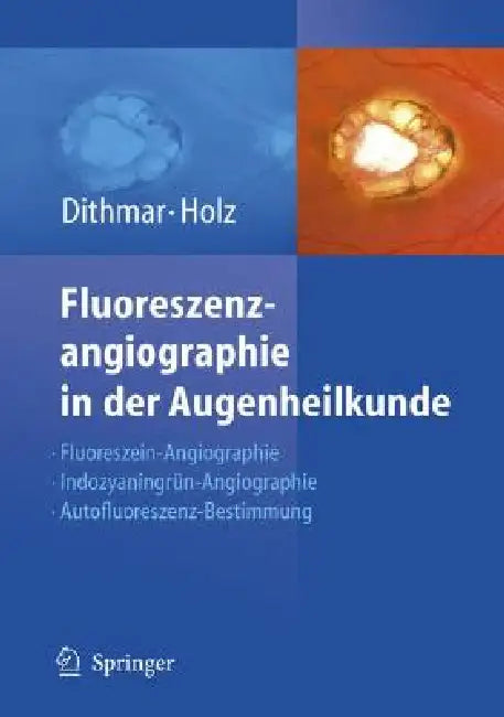 Fluoreszenzangiographie in Der Augenheilkunde: Fluoreszein-Angiographie, Indozyaningrün-Angiographie Und Fundus-Autofluoreszenz by Stefan Dithmar, Frank G. Holz
