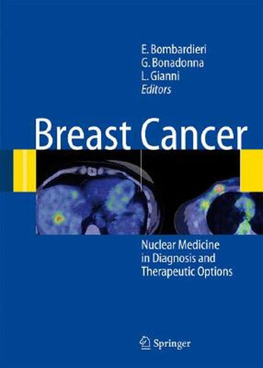 Breast Cancer: Nuclear Medicine in Diagnosis and Therapeutic Options by Emilio Bombardieri