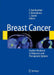 Breast Cancer: Nuclear Medicine in Diagnosis and Therapeutic Options by Emilio Bombardieri