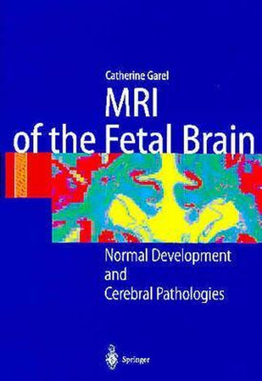 MRI of the Fetal Brain: Normal Development and Cerebral Pathologies by C. Garel