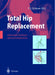 Total Hip Replacement: Implantation Technique and Local Complications by P. E. Ochsner