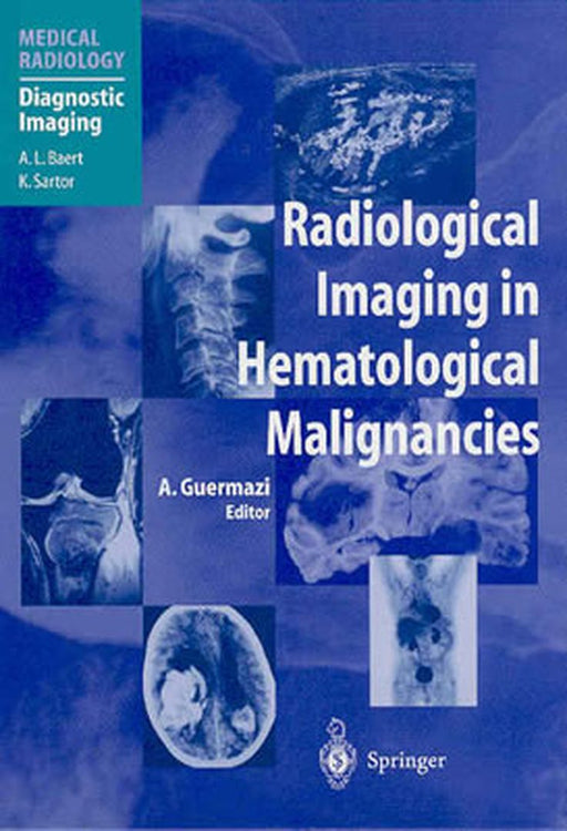 Radiological Imaging in Hematological Malignancies by Ali Guermazi