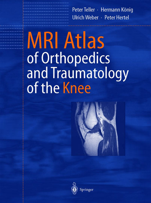 MRI Atlas of Orthopedics and Traumatology of the Knee by Hans-Karl Erik Rouette