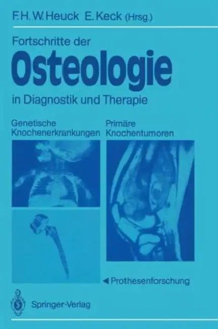 Fortschritte Der Osteologie in Diagnostik Und Therapie: Genetische Knochenerkrankungen Primäre Knochentumoren - Prothesenforschung Osteologia 3 by Friedrich H. W. Heuck, Elmar Keck