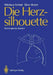 Die Herzsilhouette: Radiologische Zeichen by Nikolaus Schad, Gino Viviani