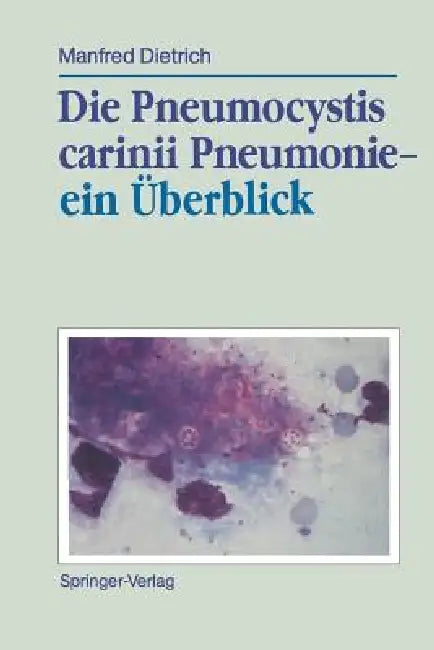 Die Pneumocystis Carinii Pneumonie-- Ein Überblick by Manfred Dietrich
