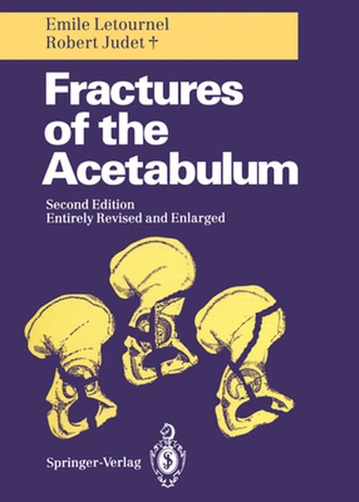 Fractures of the Acetabulum by Reginald A. Elson
