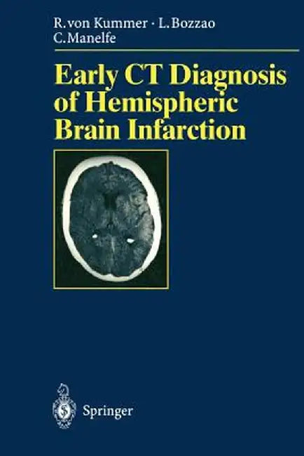 Early CT Diagnosis of Hemispheric Brain Infarction by S. Bastianello