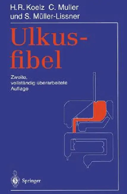Ulkusfibel by Hans R. Koelz, Claude Muller, Stefan Müller-Lissner