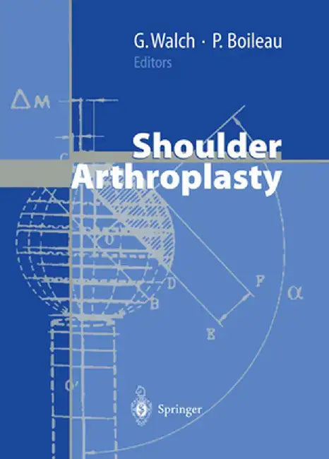 Shoulder Arthroplasty by Gilles Walch