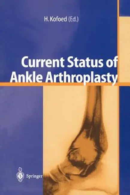 Current Status of Ankle Arthroplasty by Hakon Kofoed