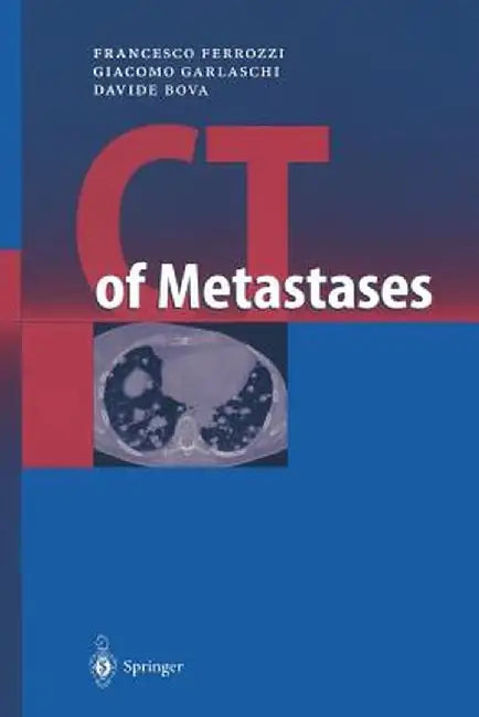 CT of Metastases by Francesco Ferrozzi