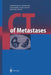 CT of Metastases by Francesco Ferrozzi