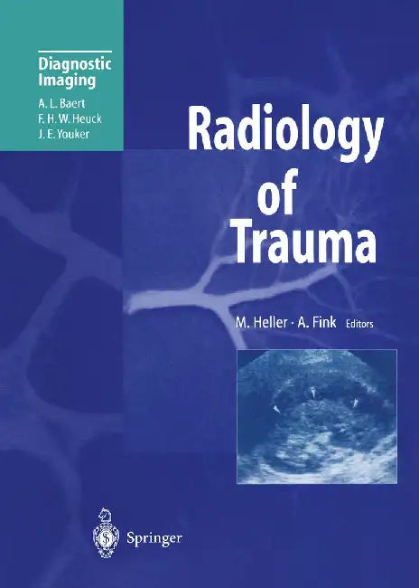 Radiology of Trauma by Martin Heller