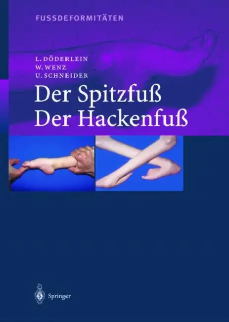 Fussdeformitaten: Der Spitzfu / Der Hackenfu by L. Dvderlein, W. Wenz, U. Schneider